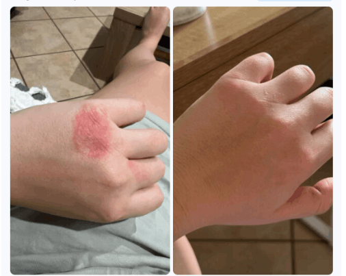 Clarexin Parasite Cleanse customer - Megan M. 34 y.o. Texas, USA